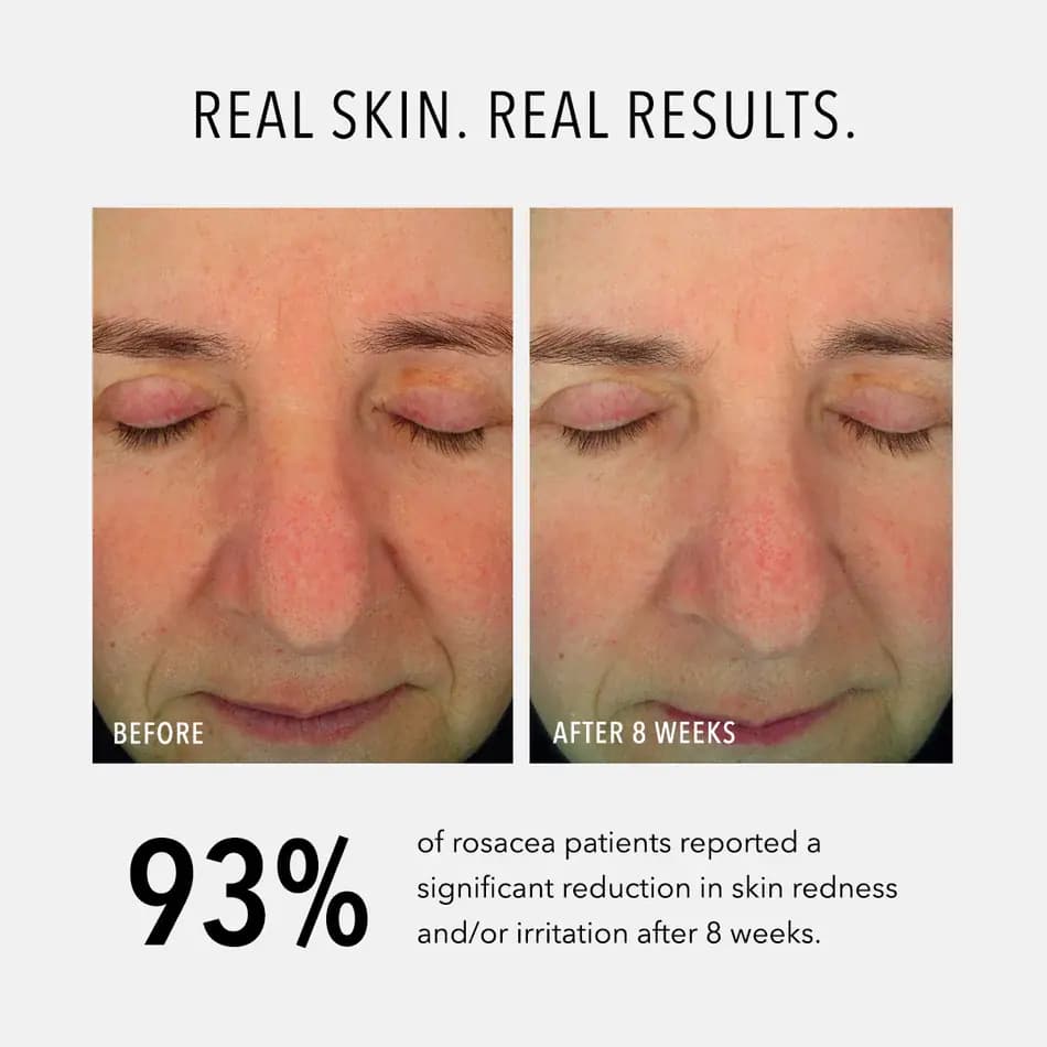 Soothing Serum